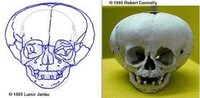 Anatomical Anomaly Art Image 8