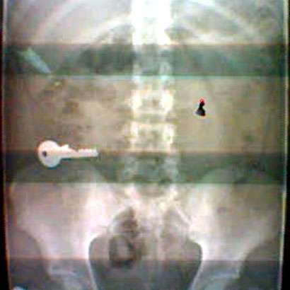 Odd X-Rays as Art