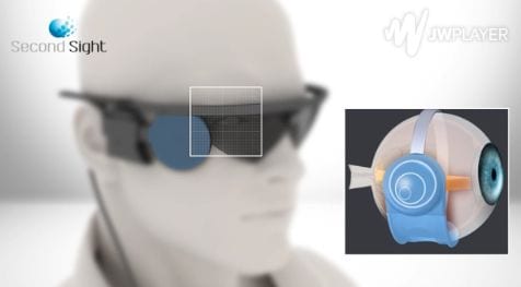 Bionic Eye Implants