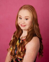 Down Syndrome Models Image 4