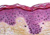 3D-Printed Skin Types Image 4
