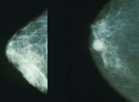 In-Shower Cancer Prevention Image 3