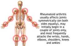 Arthritic Innovations