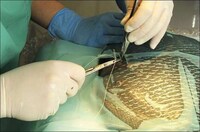 Hernia Operation On Fish Image 2