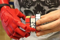 3D-Printed Prosthetic Limbs Image 2