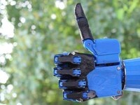 3D-Printed Prosthetic Limbs Image 4