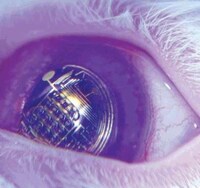 Real-Life Bionic Eyes Image 2