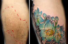 Scar-Covering Tattoos