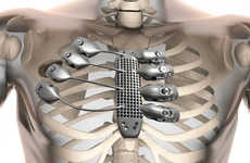 3D-Printed Chest Prosthetics