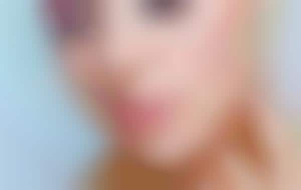 Non-Invasive Face Lifts