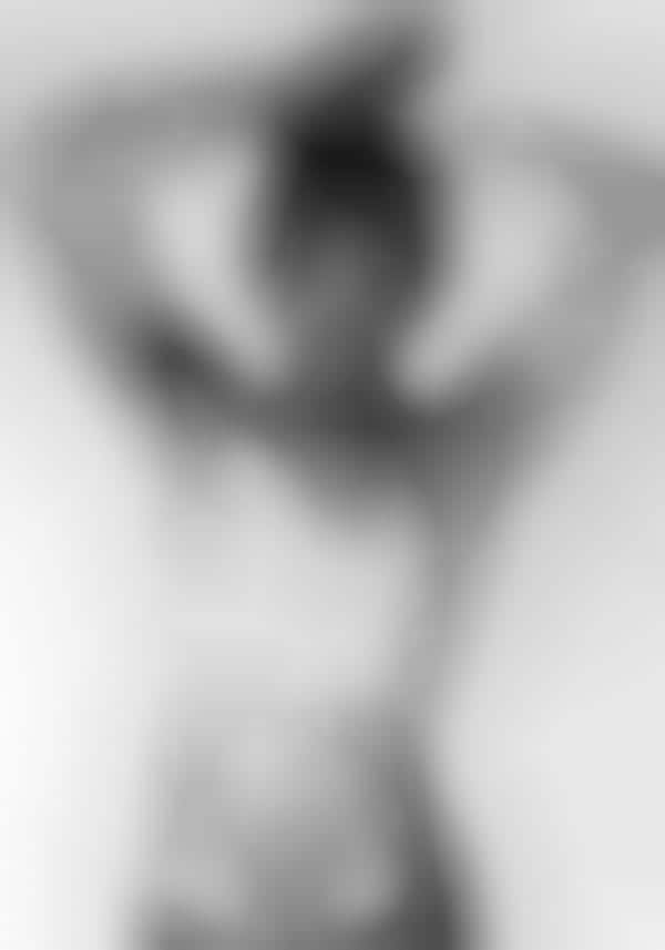 Vitiligo-Baring Photography