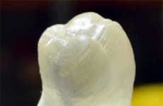 3D-Printed Dentures