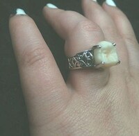 Dental Wedding Bands Image 2