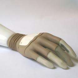 Bionic Hand Transplants