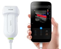 Smartphone Ultrasound Devices Image 2