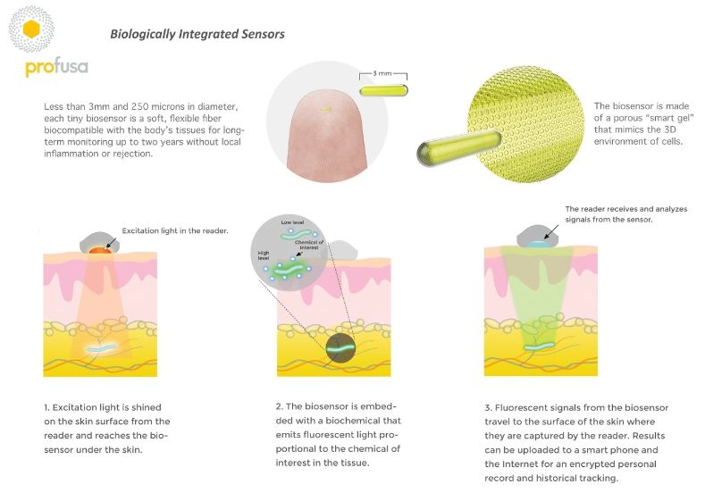 Disease-Monitoring Bio Sensors