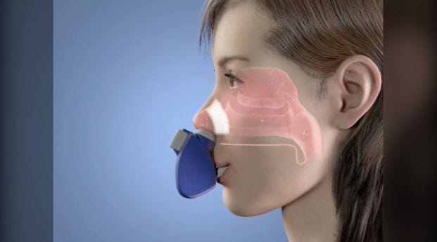 Migraine-Alleviating Inhalers