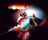 A Day in the Life of a Mouth Image 2