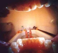A Day in the Life of a Mouth Image 3