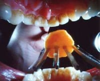 A Day in the Life of a Mouth Image 5
