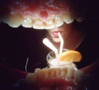 A Day in the Life of a Mouth Image 7