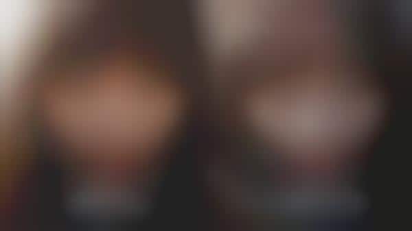 Surgery-Enhanced Selfies