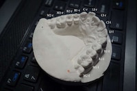 Inexpensive 3D-Printed Braces Image 2