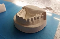 Inexpensive 3D-Printed Braces Image 3