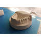 Inexpensive 3D-Printed Braces Image 3