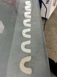 Inexpensive 3D-Printed Braces Image 4