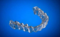 Inexpensive 3D-Printed Braces Image 5