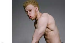 Inclusive Albino Editorials