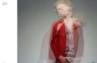 Inclusive Albino Editorials Image 2