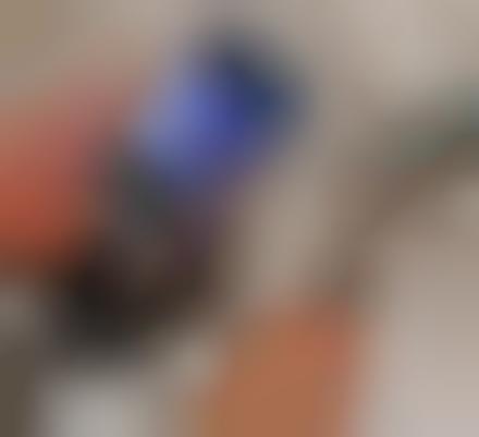 Endoscopic Smartphone Cameras