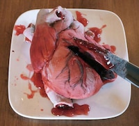 Gruesome Anatomical Cakes Image 3