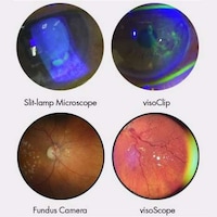 Smartphone Eye Examiners Image 4