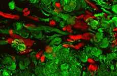 3D Printed Tumors