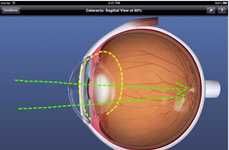 Optometrist-Assisting Apps