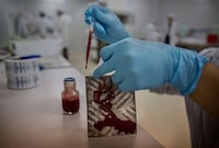Genetically Engineered Mosquitoes Image 6