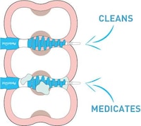Intensive Flossing Devices Image 3