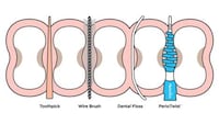 Intensive Flossing Devices Image 5