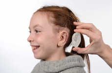 3D-Printed Ear Prosthetics