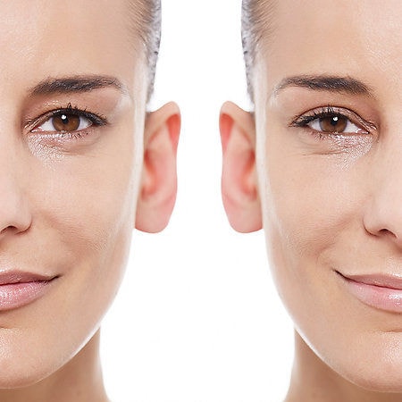 Lifting Eyelid Adhesives