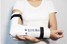 Flat-Pack Bone Casts