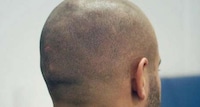 Simulated Hair Tattoos Image 3