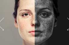 Skin Health UV Cameras