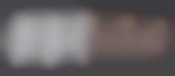 Accurate 3D Selfies