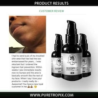 All-Natural Ingrown Hair Aids Image 6