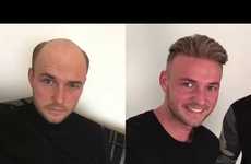 Modern Non-Surgical Hair Replacements