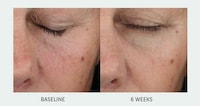 Micropolymer Facial Serums Image 2